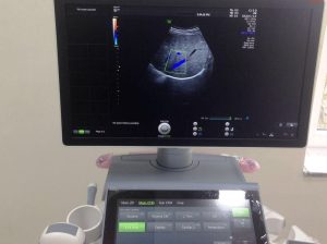 Vend Echographe GE VOLUSON E10