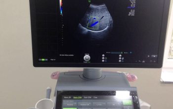 Vend Echographe GE VOLUSON E10